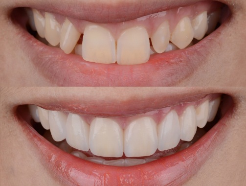 Cosmetic Dentistry